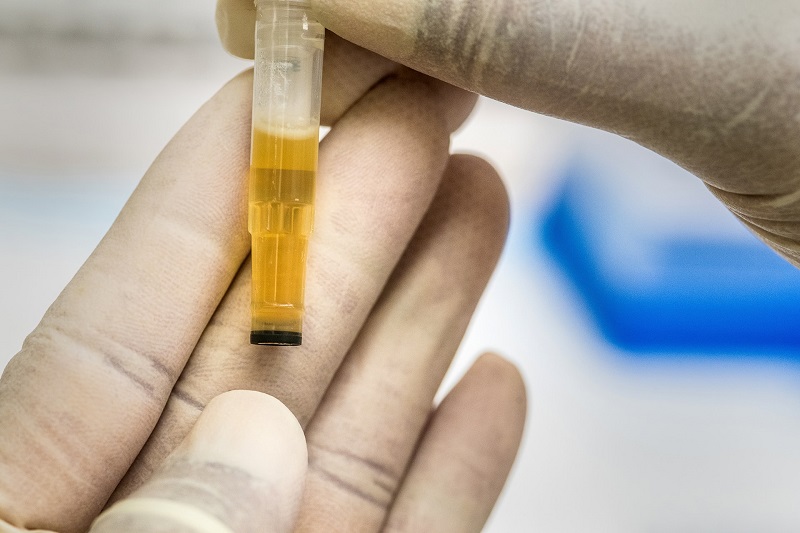 Test de drogas - Detectar drogas, cocaína o cannabis en el cuerpo